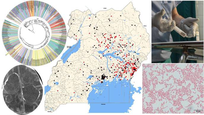 Bacteria Virus Combo May Be Cause of Neonatal Brain Infections in Uganda