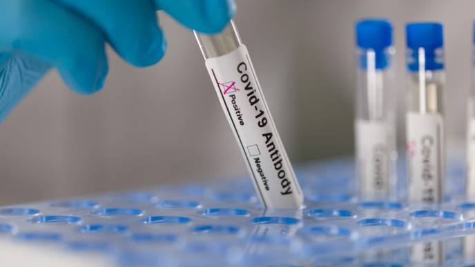 Promising Results for Regeneron's Antibody Cocktail for COVID-19
