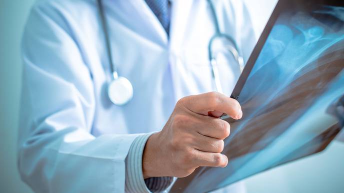 MedUni Vienna Study Enhances Understanding of Osteosarcoma Disease Mechanisms