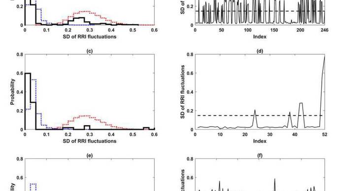 Critical Transition Theory Shows Flickering in Heart Before Atrial Fibrillation