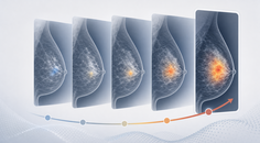 longitudinal mammographic deep learning risk scores track future cancer