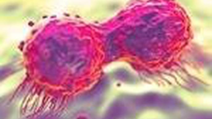 Drug Used to Treat Breast & Ovarian Cancer Can Transform Treatment for Prostate Cancer