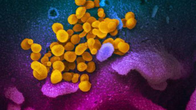 COVID-19 Diagnostic Might Be Tested on Patient Samples Soon