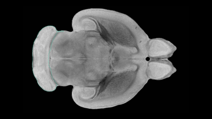 Simple Treatment During Pregnancy Can Protect Baby from Memory Problems Later in Life