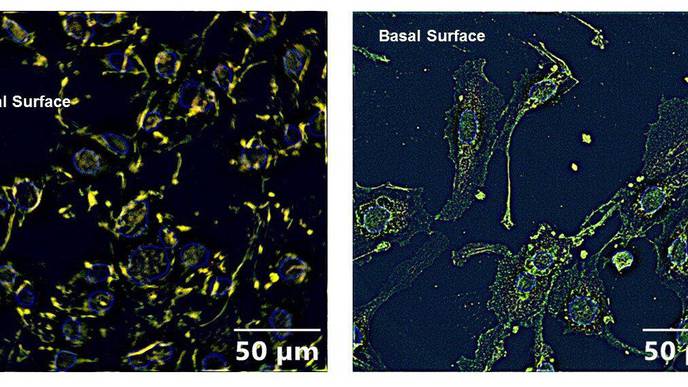 Cell Study Suggests Pesticide Exposure May Increase COVID-19 Susceptibility