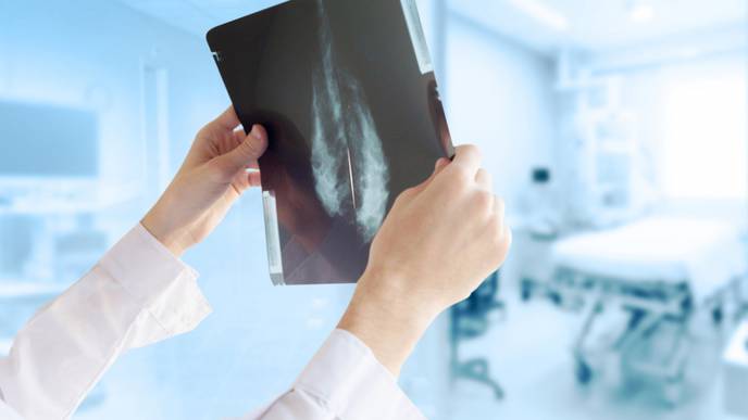 Screening Women in 40s for Breast Cancer Saves Lives