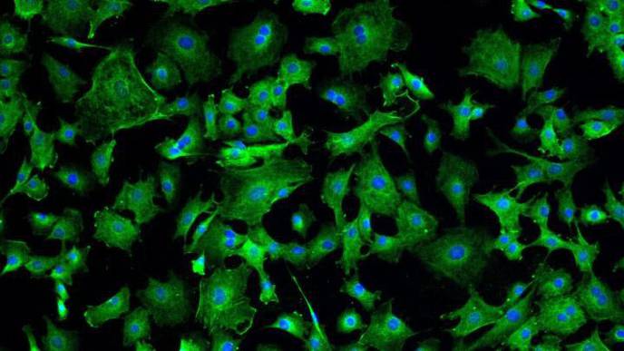 Patients Improve After Heart Cell Therapy