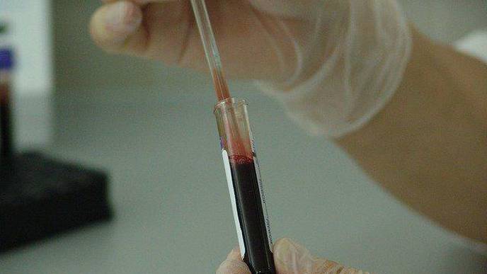 Blood-Based Assay Could Soon Surface in Colorectal Cancer