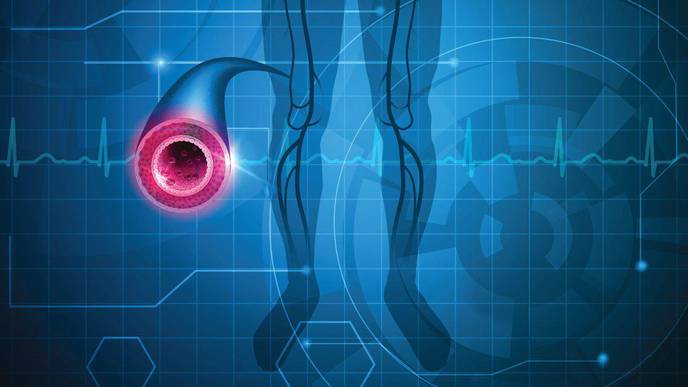 Heart Disease Medications Underused Among Hispanic/Latino Populations with PAD