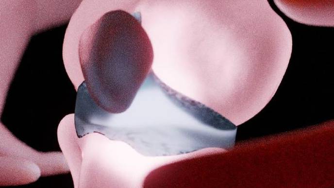 Screening Approach Opens Path to Better-Quality Joint Cartilage