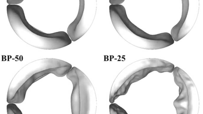 Engineers Find Thinner Tissues in Replacement Heart Valves Create Problematic Flutter