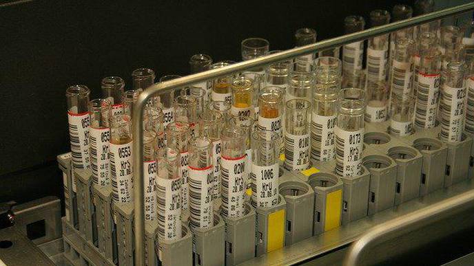 Molecules in Urine Allow Doctors to Monitor Skin Cancer